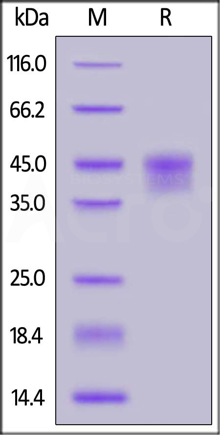 Human IL-21 R, His Tag (Cat. No. ILR-H5226) SDS-PAGE gel