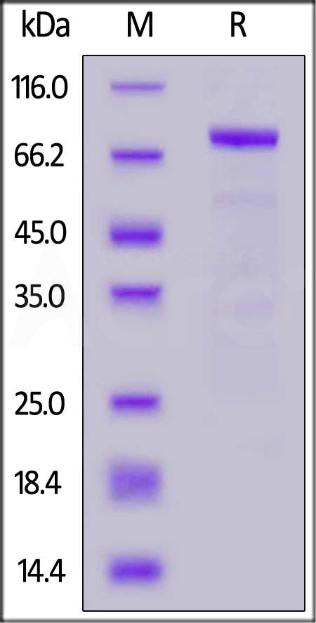 Human IL-11 R alpha, Fc Tag (Cat. No. ILR-H5256) SDS-PAGE gel