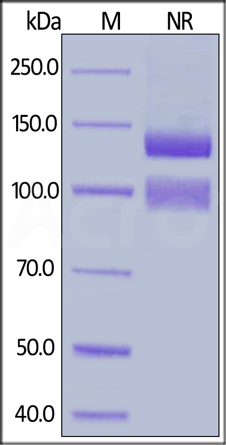 Human ITGAV&ITGB1 Heterodimer Protein, His Tag&Tag Free (Cat. No. IT1-H52E1) SDS-PAGE gel