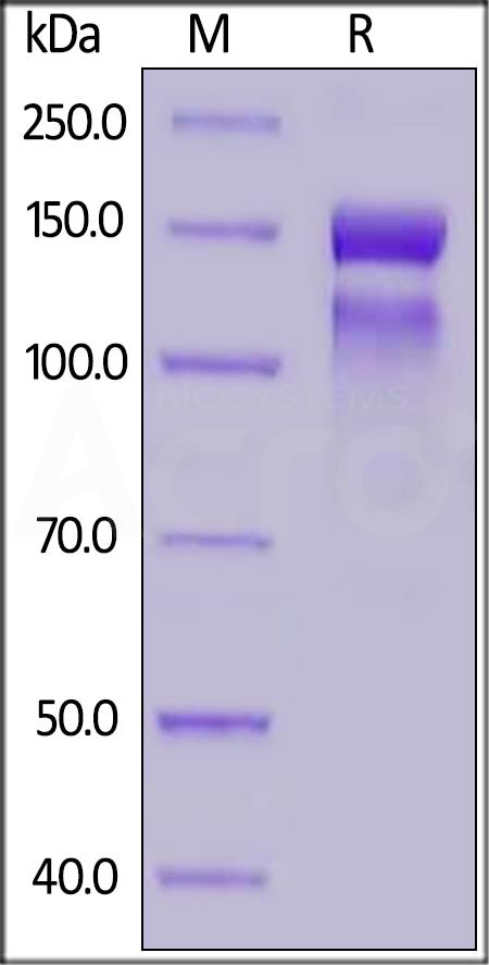Human ITGA10&ITGB1 Heterodimer Protein, His Tag&Tag Free (Cat. No. IT1-H52Wa) SDS-PAGE gel