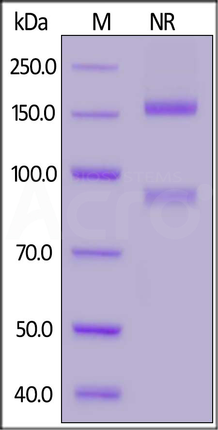 Human ITGAM&ITGB2 Heterodimer Protein, His Tag&Tag Free (Cat. No. IT2-H52W4) SDS-PAGE gel
