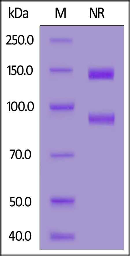 Human ITGAV&ITGB3 Heterodimer Protein, His Tag&Tag Free (Cat. No. IT3-H52E3) SDS-PAGE gel