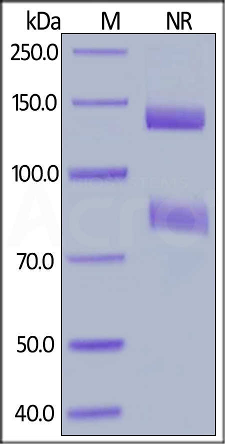Mouse ITGAV&ITGB8 Heterodimer Protein, His Tag&Tag Free (Cat. No. IT8-M52W6) SDS-PAGE gel