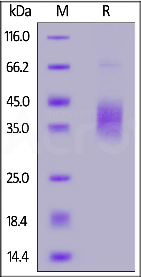 Human LAP (TGF-beta 1), Tag Free (Cat. No. LAP-H5213) SDS-PAGE gel