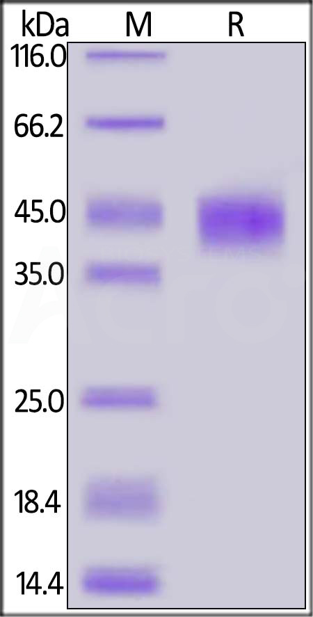 Human LAP (TGF-beta 1), His Tag (Cat. No. LAP-H5245) SDS-PAGE gel