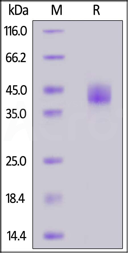 Biotinylated Human LAP (TGF-beta 1), His,Avitag (Cat. No. LAP-H82Q6) SDS-PAGE gel