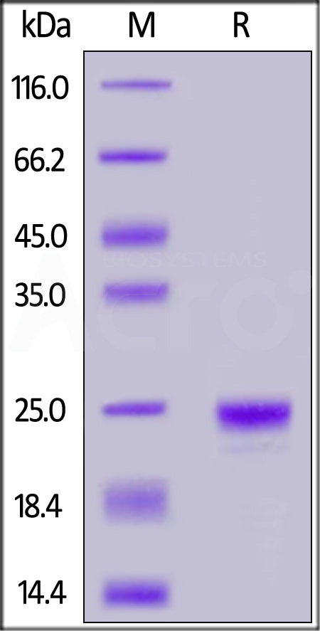 Human Lipocalin-2, His Tag (Cat. No. LC2-H5222) SDS-PAGE gel