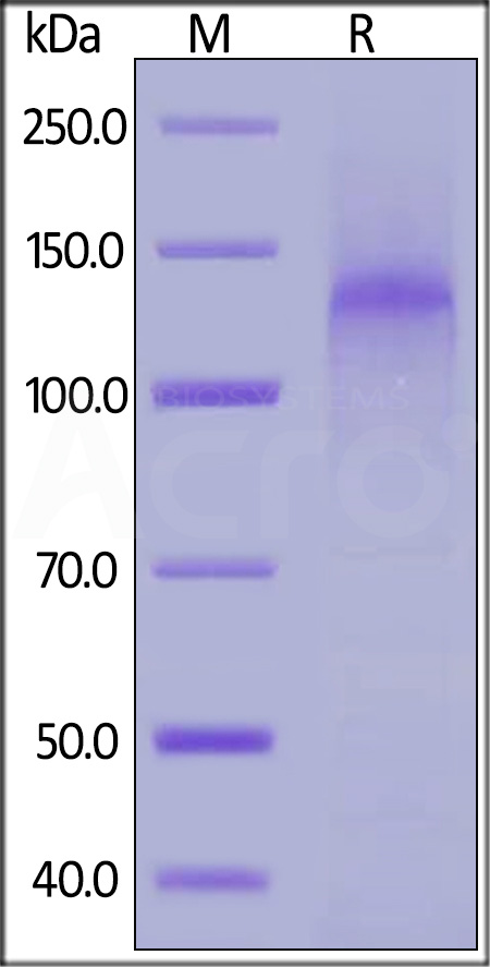 Human LDL R, His Tag (Cat. No. LDR-H5224) SDS-PAGE gel