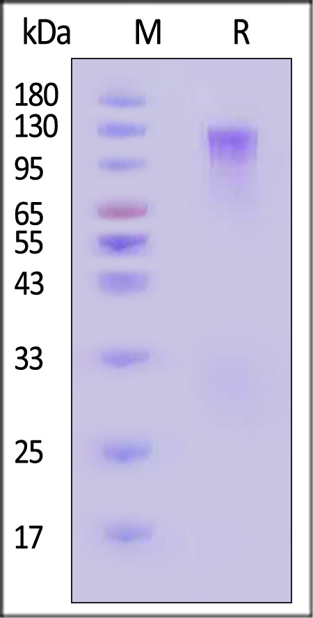 Mouse LDL R, His Tag (Cat. No. LDR-M52H8) SDS-PAGE gel