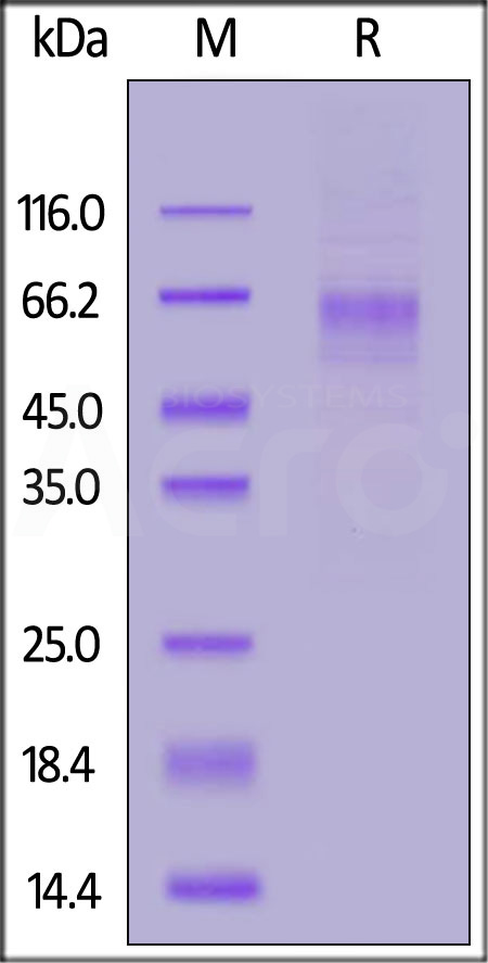 Human LIV-1, His Tag (Cat. No. LV1-H5223) SDS-PAGE gel