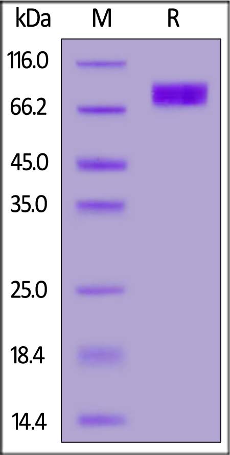 Human LIV-1, Fc Tag (Cat. No. LV1-H5255) SDS-PAGE gel