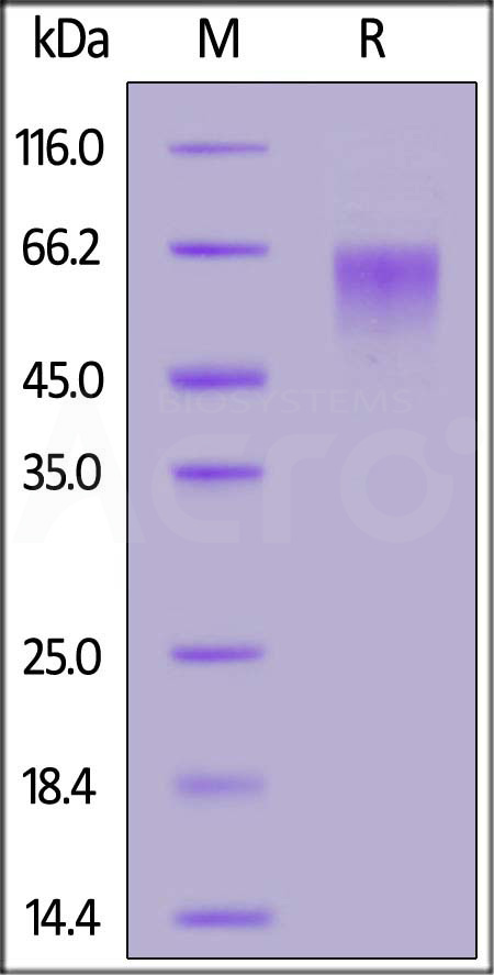 Biotinylated Human LIV-1, His,Avitag (Cat. No. LV1-H82E3) SDS-PAGE gel