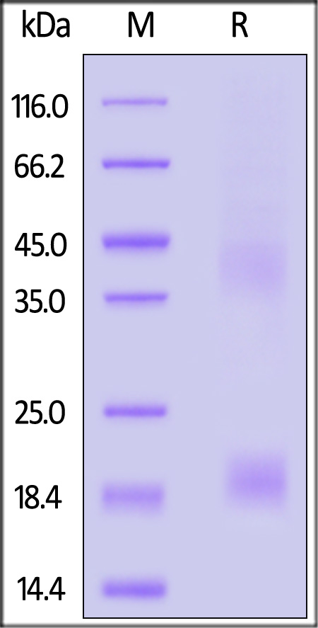 LYPD1 SDS-PAGE