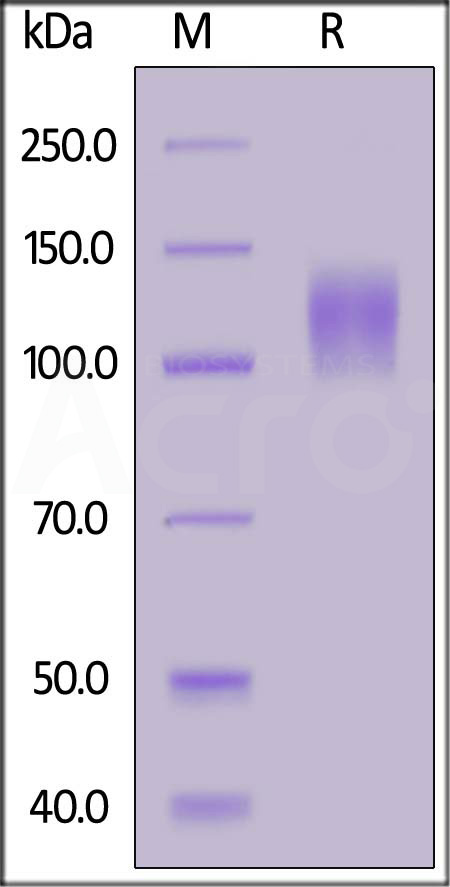 Cynomolgus MERTK, Fc Tag (Cat. No. MEK-C5253) SDS-PAGE gel