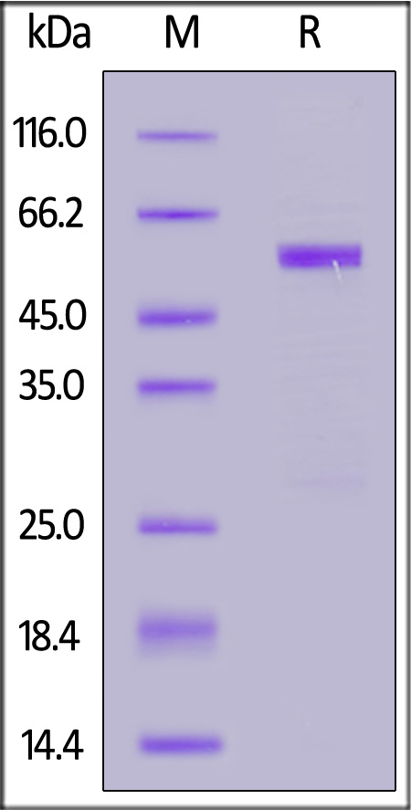 Human MMP-1, His Tag (Cat. No. MM1-H5222) SDS-PAGE gel