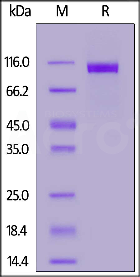 Biotinylated Human NCAM-1, His,Avitag (Cat. No. NC1-H82E3) SDS-PAGE gel