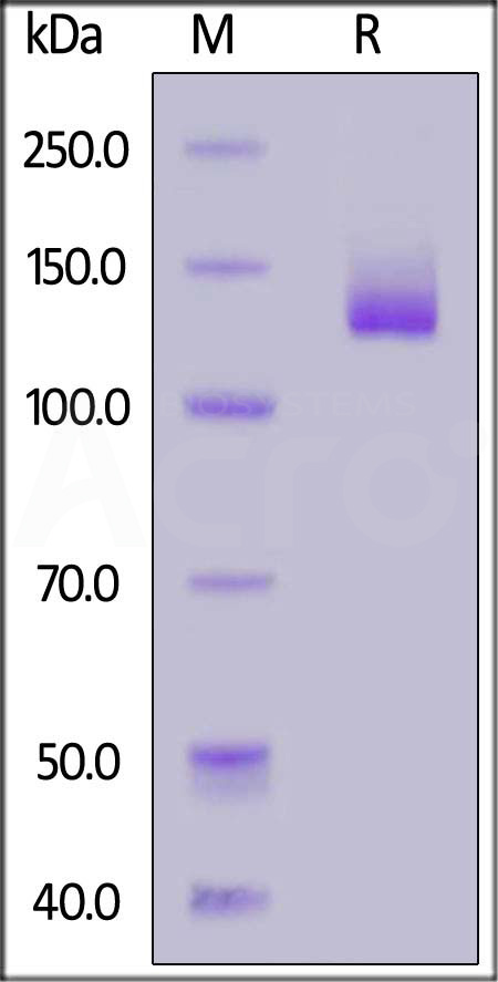 FITC-Labeled Human NCAM-1, Fc Tag (Cat. No. NC1-HF256) SDS-PAGE gel