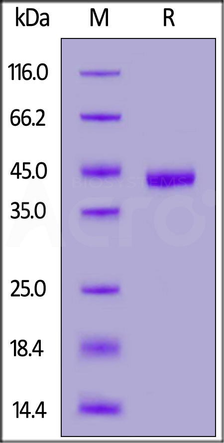 Mouse Nectin-4, His Tag (Cat. No. NE4-M52Ha) SDS-PAGE gel