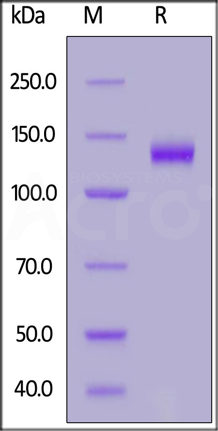 Human Netrin receptor DCC, His Tag (Cat. No. NEC-H52H3) SDS-PAGE gel