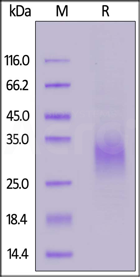 Cynomolgus NKG2A, His Tag (Cat. No. NKA-C5245) SDS-PAGE gel