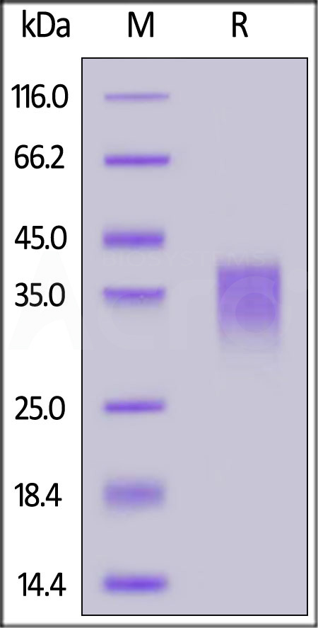 Human NKG2C, His Tag (Cat. No. NKC-H5248) SDS-PAGE gel
