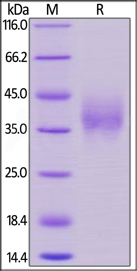 Biotinylated Human NTB-A, His,Avitag (Cat. No. NTA-H82E6) SDS-PAGE gel