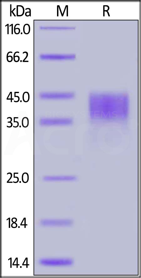 Human CD200, His Tag (Cat. No. OX2-H5228) SDS-PAGE gel
