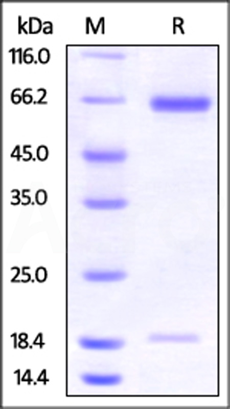 Hamster PCSK9, His Tag (Cat. No. PC9-H52E4) SDS-PAGE gel