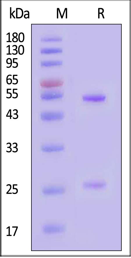 pre-Gc protein SDS-PAGE