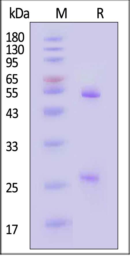 pre-Gc protein SDS-PAGE