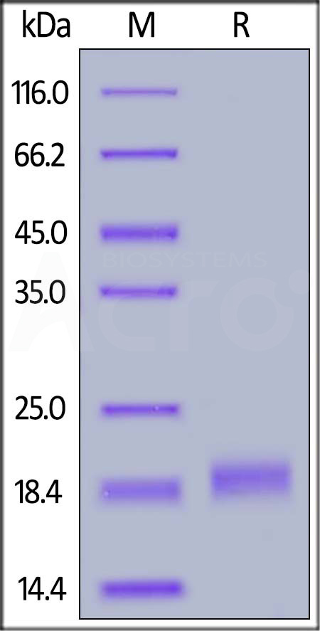 Human / Cynomolgus / Rhesus macaque ROR1 (165-305, Frizzled domain), His Tag (Cat. No. RO1-H5222) SDS-PAGE gel