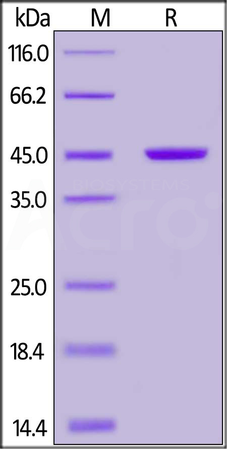 Recombinant Protein L, His Tag (Cat. No. RPL-P3141) SDS-PAGE gel