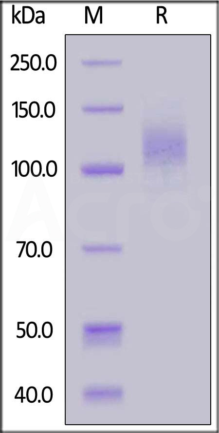 SARS-CoV-2 S1 protein, His Tag (Cat. No. S1N-C52Hp) SDS-PAGE gel