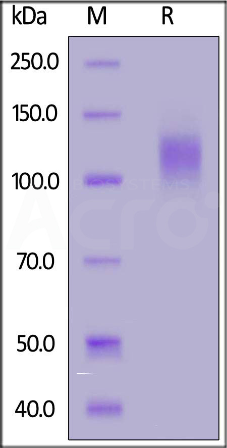 SARS-CoV-2 S1 protein, His Tag (Cat. No. S1N-C52Hr) SDS-PAGE gel