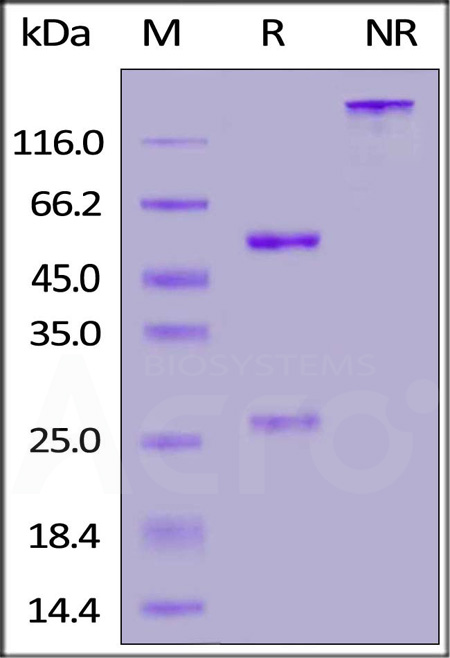 Anti-SARS-CoV-2 Spike RBD Antibody, Chimeric mAb, Human IgG1 (AM122) (Cat. No. S1N-M12A1) SDS-PAGE gel
