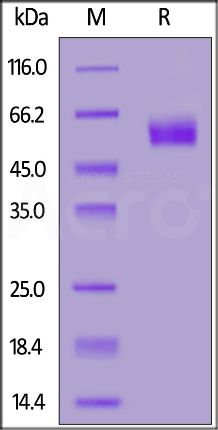 Human SIRP alphaV2 Protein, His Tag (Cat. No. SI2-H52H9) SDS-PAGE gel