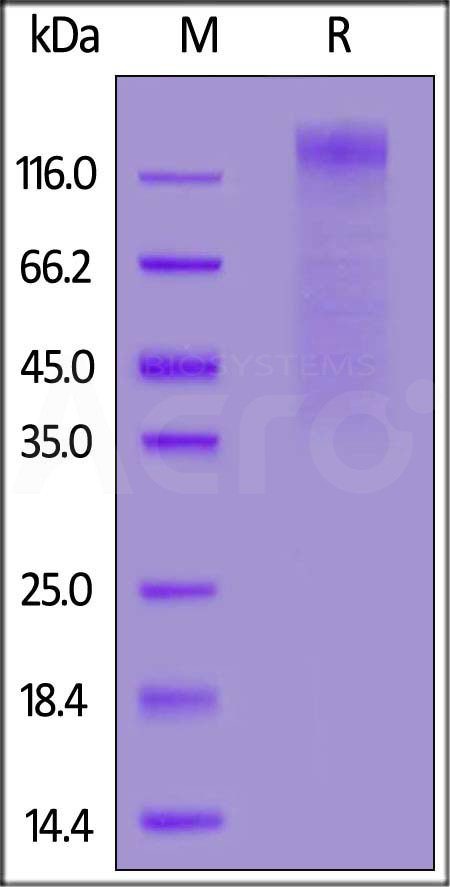 HCoV-NL63 S1 protein, His Tag (Cat. No. SIN-V52H3) SDS-PAGE gel