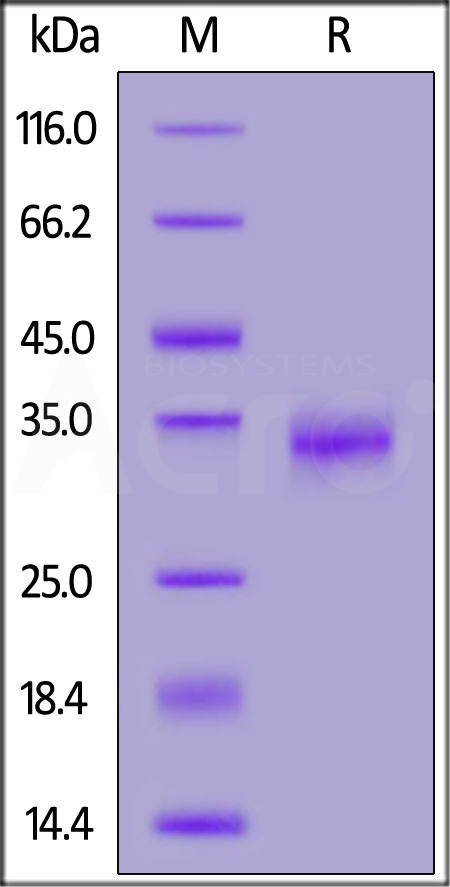 SARS-CoV-2 S protein RBD (K417N), His Tag (Cat. No. SPD-C52Hs) SDS-PAGE gel