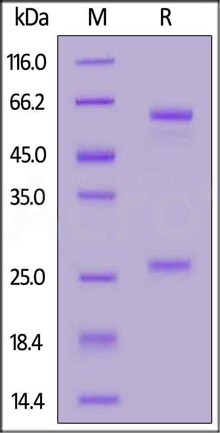 Anti-SARS-CoV-2 Spike RBD Antibody, Chimeric mAb, Human IgA2 (AM130) (Cat. No. SPD-M196b) SDS-PAGE gel