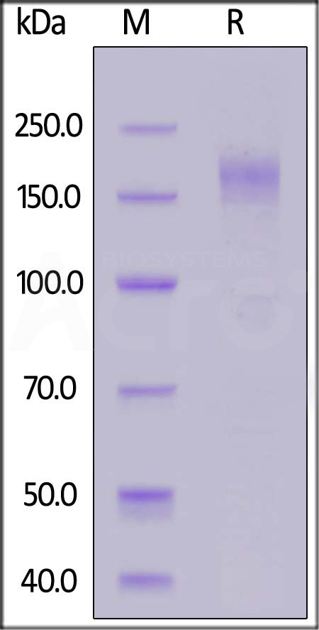 HCoV-229E Spike protein, His Tag (Cat. No. SPN-H52H3) SDS-PAGE gel