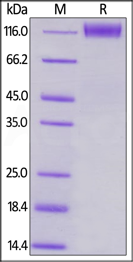 Human CD96 Protein, Mouse IgG2a Fc Tag (Cat. No. TAE-H5252) SDS-PAGE gel