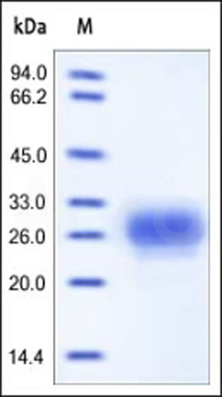 Human TFPI-2, His Tag (Cat. No. TF2-H5227) SDS-PAGE gel