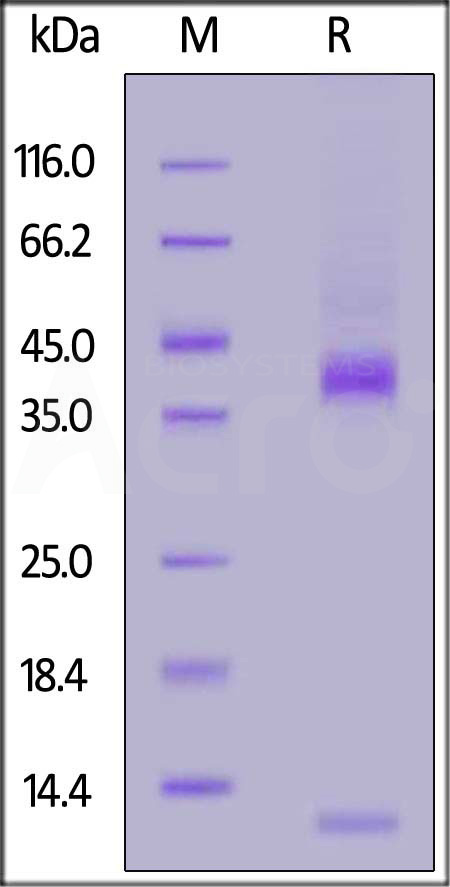 Mouse Latent TGFB1, His Tag (Cat. No. TG1-M5245) SDS-PAGE gel