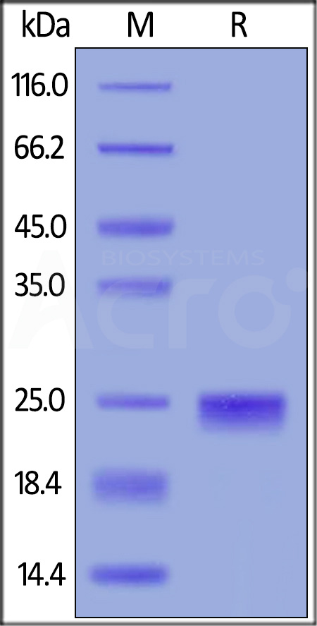 Human TIMP-2, His Tag (Cat. No. TI2-H5223) SDS-PAGE gel
