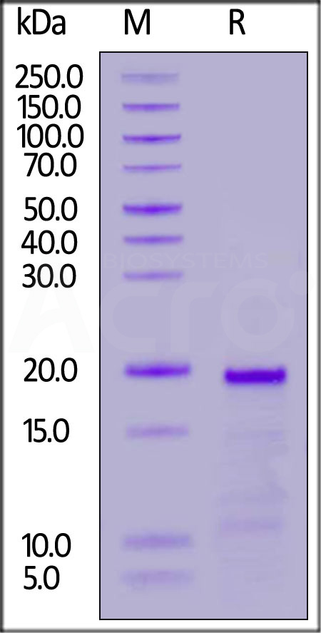 Human TOP2A, Tag Free (Cat. No. TOA-H5117) SDS-PAGE gel