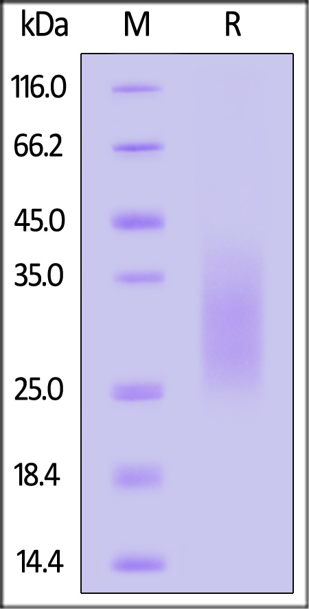 Human TRAC, His Tag (Cat. No. TRC-H52H3) SDS-PAGE gel