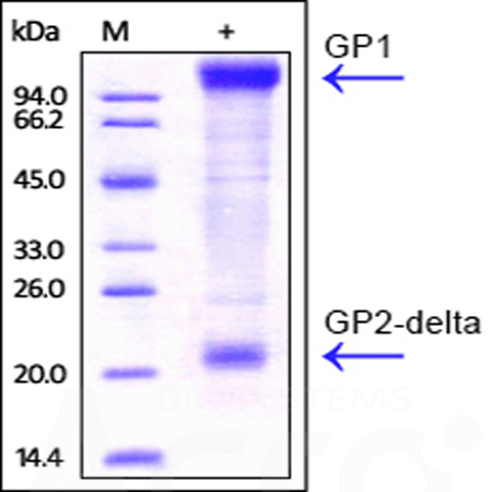 Ebolavirus EBOV (subtype Zaire, strain Kikwit-95) GP, His Tag (Cat. No. ZE5-V5221) SDS-PAGE gel