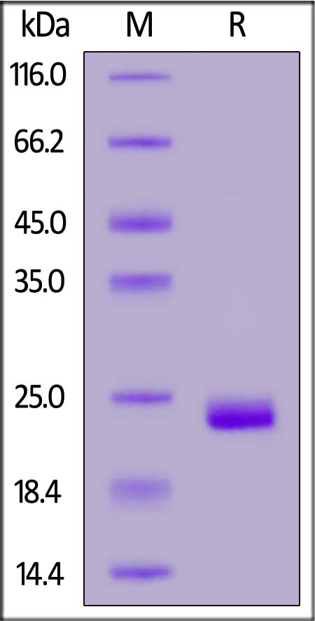 Human ZNRF3, His Tag (Cat. No. ZN3-H52H3) SDS-PAGE gel