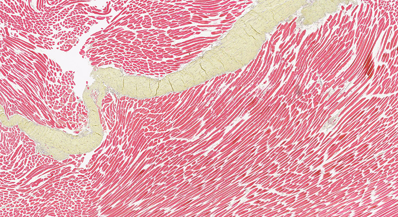 肌肉组织 荧光桃红法染色4X