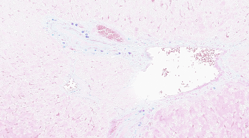 大鼠肝脏 肥大细胞染色 20X